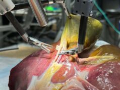 Robô cirúrgico dá um passo em direção à cirurgia totalmente autônoma