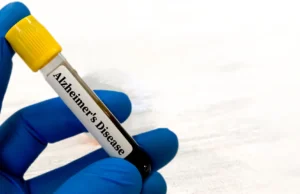 Exames de sangue para a doença de Alzheimer podem ser enganosos para pessoas com problemas renais