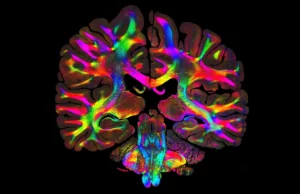 A simples recepção de luz revela os caminhos ocultos do cérebro em detalhes microscópicos