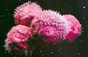 Os compostos de cannabis CBD e THC mostram-se promissores na luta contra o câncer de ovário