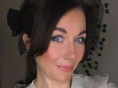 Condição de pele ‘dolorosa’ deixa mãe de dois filhos com aparência de ‘queimadura solar permanente’ com inchaço no rosto