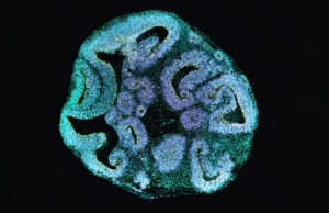 Cientistas revelam por que alguns cérebros param de crescer muito cedo