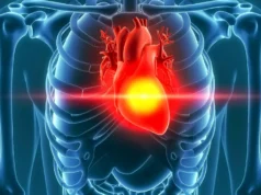 Um ponto de inflexão precoce é quando o risco cardíaco nos homens acelera