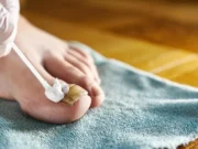 O cheiro de ovo podre que pode finalmente derrotar fungos nas unhas