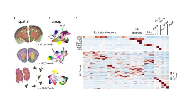 Protocol-for-Xenium-spatial-transcriptomics-studies-using-fixed-frozen-mouse-brain-sections.jpg