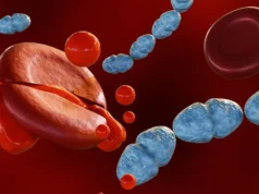 Medicamento revolucionário para sepse mostra-se promissor em testes em humanos