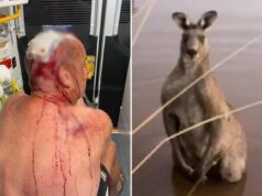 Homem australiano tem sorte de estar vivo depois de ser espancado em um violento ataque de canguru