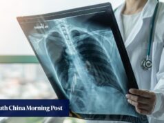 A Malásia corre o risco de subnotificação de casos de TB como uma “epidemia de combustão lenta”