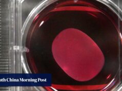 Japão aprova primeira medicina regenerativa do mundo usando células iPS