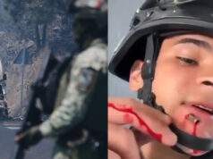 “Eu parei uma bala na minha cara”