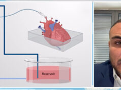 Opiniões contrárias sobre novo transplante de coração para menino napolitano