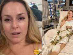 “Dias difíceis, cirurgia novamente amanhã”