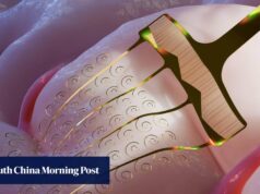 A arte japonesa de cortar papel inspira implantes cerebrais flexíveis na China