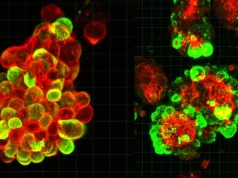 Uma aliança secreta de células pode explicar por que o câncer de ovário é tão mortal