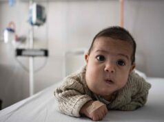 Uma criança que sofre de um hemangioma raro é tratada no útero na França, o primeiro desse tipo