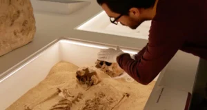 DNA antigo desvenda o mistério de 12.000 anos de raro distúrbio de crescimento genético