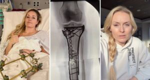 Esquiador revela medo de amputação após trágico acidente nos Jogos Olímpicos de Inverno de 2026