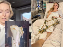 Lindsay Vaughn admite que a cirurgia salvou sua amputação de perna