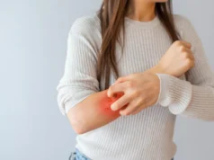 Cientistas descobrem a camada oculta de açúcar por trás da psoríase