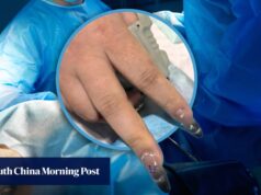 Um hospital chinês chamou uma manicure para remover as unhas postiças de uma mulher antes do tratamento de emergência