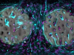 Um implante de hidrogel impresso a laser pode revolucionar o reparo ósseo