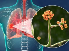 Esta simples proteína do sangue pode deter o fungo negro mortal