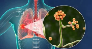 Esta simples proteína do sangue pode deter o fungo negro mortal