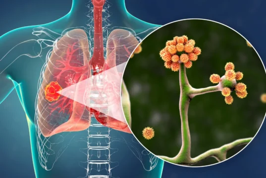 Esta simples proteína do sangue pode deter o fungo negro mortal