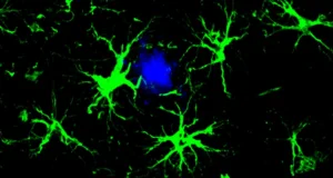 Cientistas estão transformando células cerebrais em agentes para limpar a placa de Alzheimer