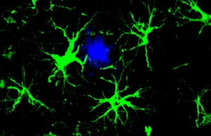 Cientistas estão transformando células cerebrais em agentes para limpar a placa de Alzheimer