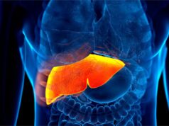 Fígado gorduroso: táticas para reduzi-lo com métodos naturais