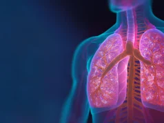 Uma forma grave de COVID ou gripe pode aumentar o risco de câncer de pulmão anos depois