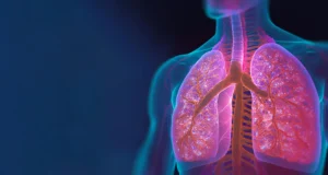 Uma forma grave de COVID ou gripe pode aumentar o risco de câncer de pulmão anos depois