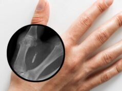 Novos microchips da Web para funcionários serão banidos em breve no estado de Washington