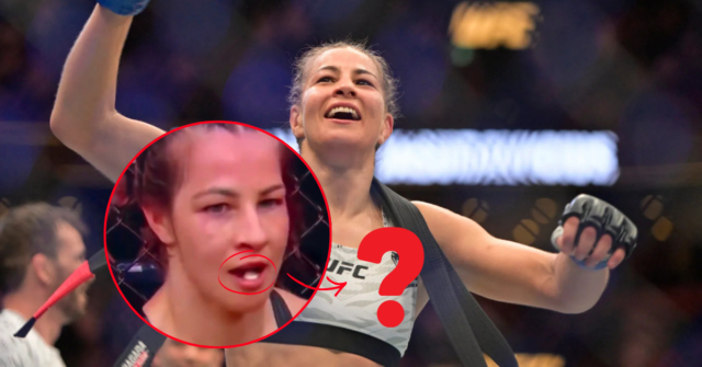 Jasmine-Jasudavicius-Reveals-What-Was-Really-in-Her-Mouth-During-UFC-Winnipeg-Fight.png