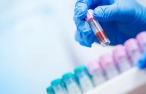 Um simples exame de sangue pode detectar o risco de Alzheimer anos antes