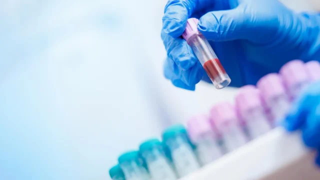 blood-sample-test-clinic-laboratory.webp.webp
