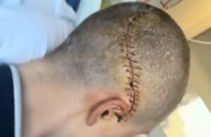 Cavaleiro norueguês (19) compartilha foto de confronto após hemorragia cerebral em Paris-Roubaix: ‘Tenho muita sorte’