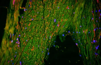 Cientistas acabam de encontrar um “dreno” oculto no cérebro humano