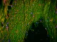 Cientistas acabam de encontrar um “dreno” oculto no cérebro humano