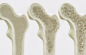 Os cientistas podem ter encontrado uma maneira de manter os ossos fortes para o resto da vida