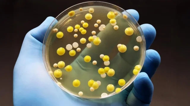 superbug-bacteria-petri-dish-gloved-hand.webp.webp