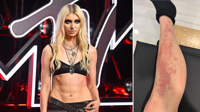 taylor-momsen-spider-bite.jpg