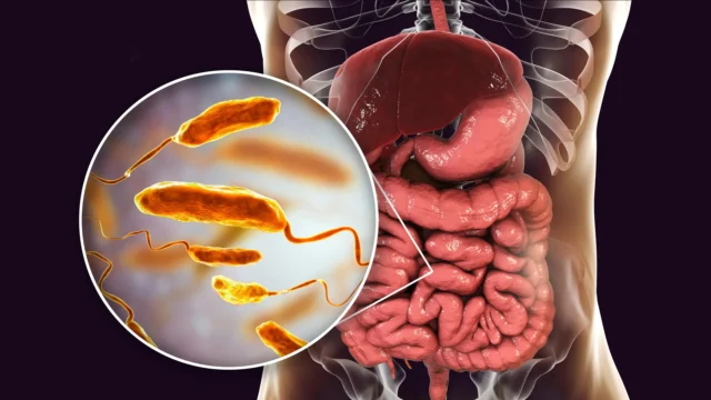 vibrio-cholerae-bacteria-in-small-intestine.webp.webp
