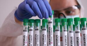 Hantavírus, últimas notícias sobre infecções: teste de turista inglês negativo