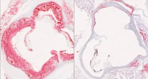 Cientistas descobriram o interruptor oculto do fígado que reduz o colesterol ruim