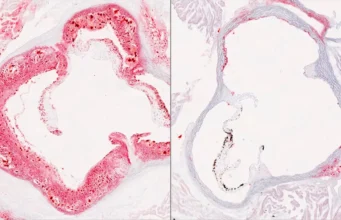 Cientistas descobriram o interruptor oculto do fígado que reduz o colesterol ruim