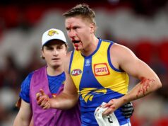 O técnico do West Coast Eagles, Andrew McQualter, está “preocupado” com o zagueiro Harry Edwards após a escolha da terceira rodada de 2026