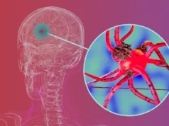 Os pesquisadores estão bloqueando uma proteína chave que ajuda a doença de Parkinson a se espalhar pelo cérebro