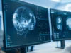 Os cientistas pensaram que a inflamação do cérebro era a causa da COVID persistente, mas os exames contaram uma história diferente